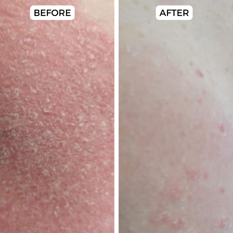 Side-by-side comparison of skin showing 'before' and 'after' results